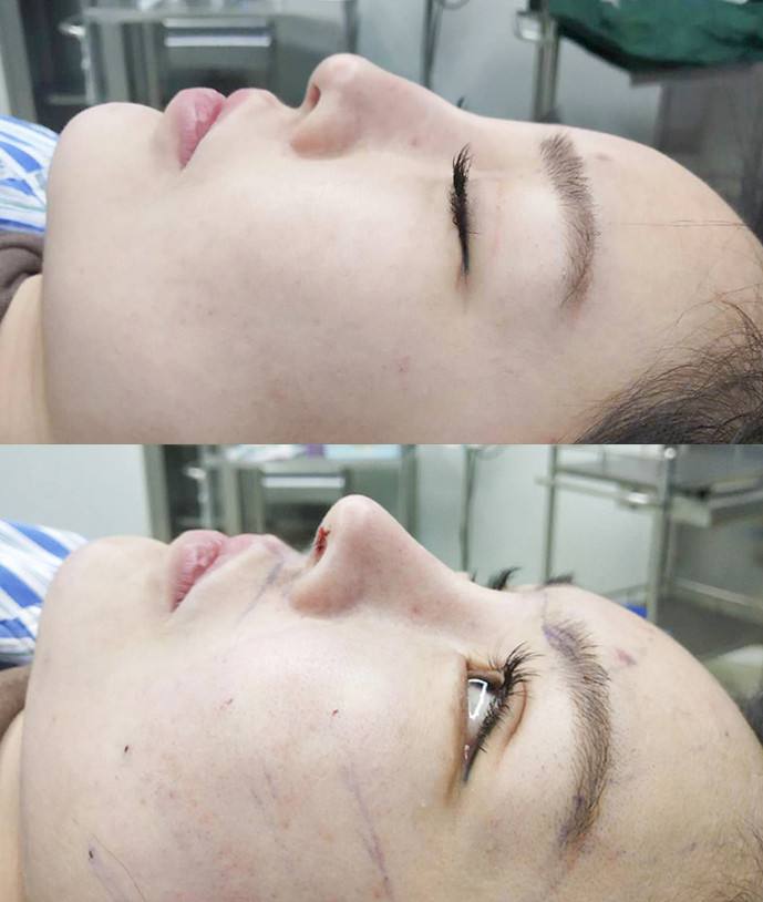 中国鼻部整形专家排名前十 中国鼻部整形医生预约前十名