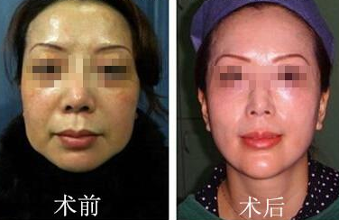 祝东升和杨大平哪个提升效果好