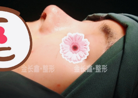 2022年西京医院做鼻子做得好的大夫是谁？