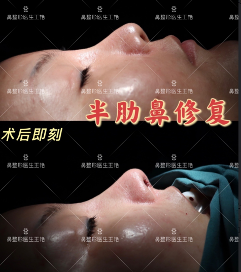 2022年上海鼻修复哪个医生预约最多？