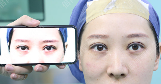 上海华美佀同帅修复双眼皮技术怎么样？