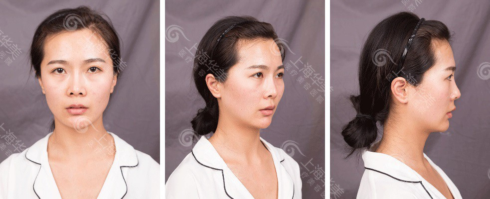 上海鼻综合专家哪位最靠谱？哪位做的效果自然？