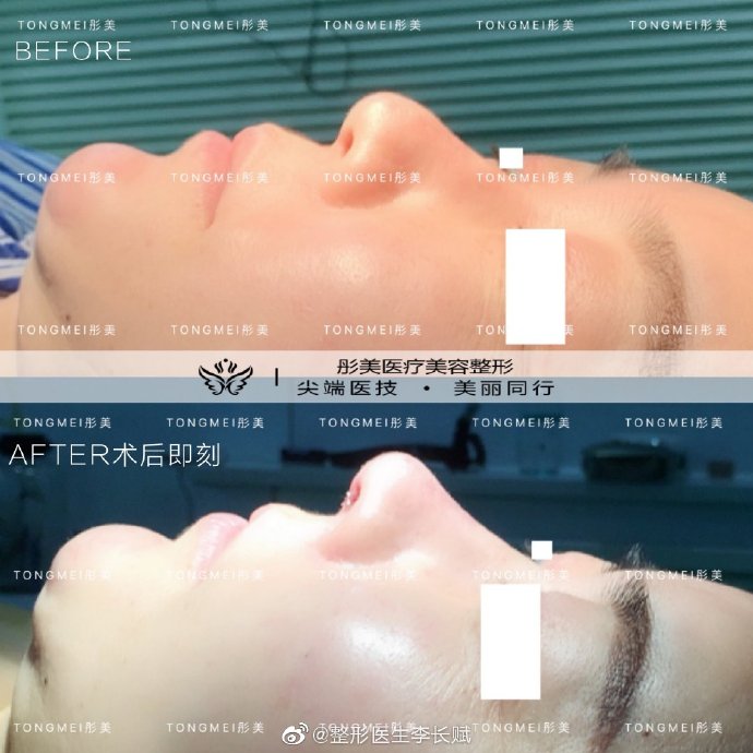 北京鼻综合专家排名哪个最好最靠谱？