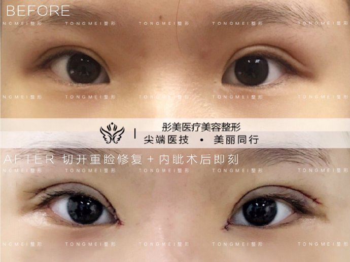 北京专做眼修复的医生都有哪些？