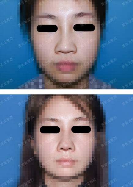 南京鼻修复专家都有哪些，技术靠谱吗？