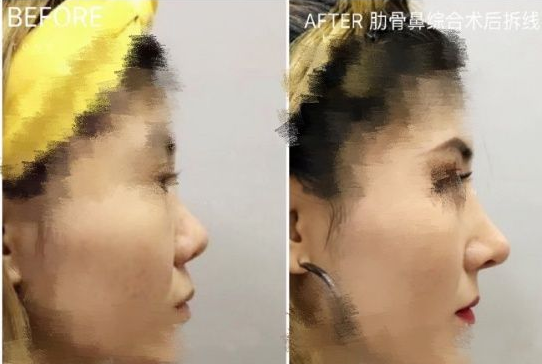 国内最厉害的鼻修复专家：范飞和戴传昌