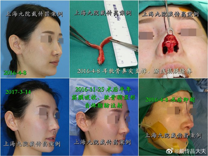 国内最厉害的鼻修复专家：范飞和戴传昌哪个好？
