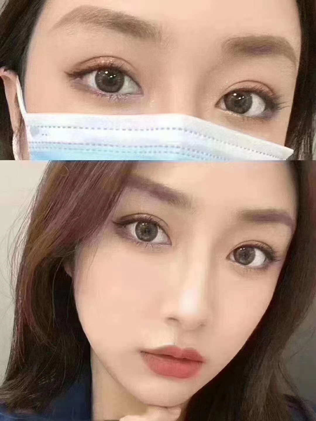 郑州哪个医生做双眼皮手术最好？郑州双眼皮医生预约排名