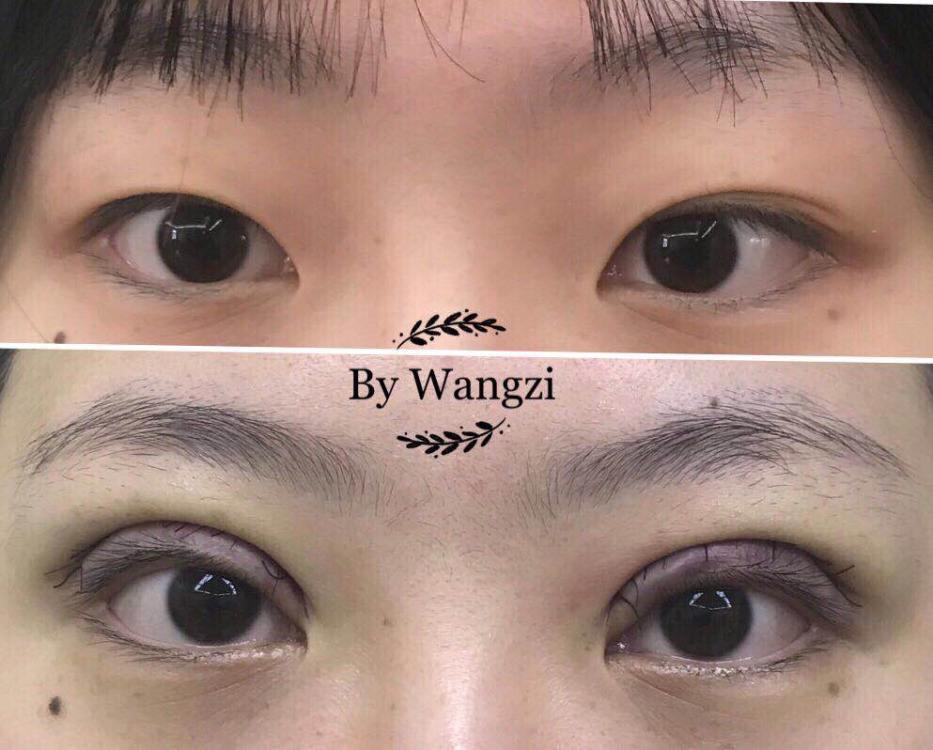 上海九院双眼皮修复专家是谁