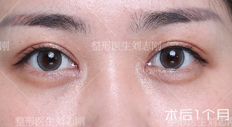 国内修复双眼皮权威专家排名 国内修复双眼皮权威医生排行榜2020