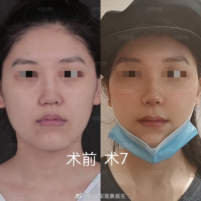 北京做鼻子修复的最好的医生