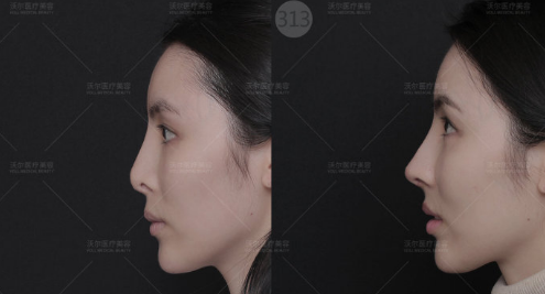 北京有没有靠谱的鼻子整容的医生？北京鼻子整容专家排名大全