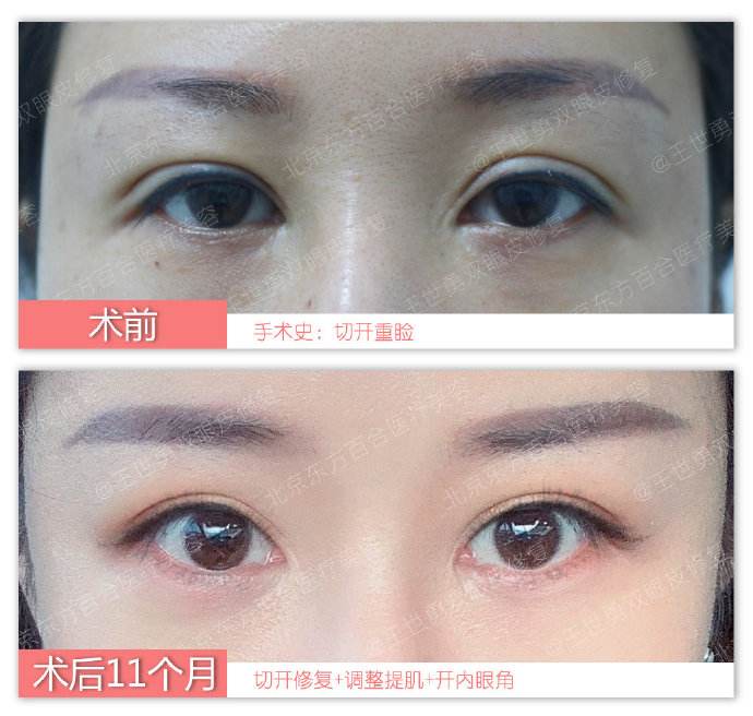 中国哪个医生眼睛修复得好