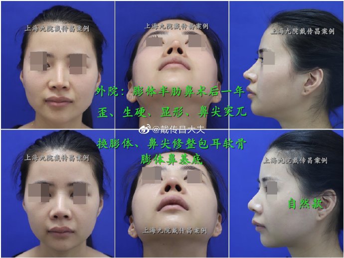 上海九院整复外科鼻修复推荐医生预约排名