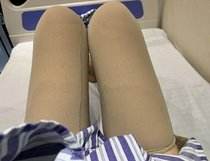 北京大腿吸脂好的医生权威专家推荐