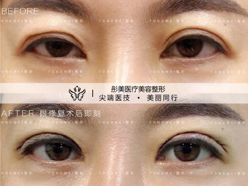 中国的眼部修复最好的专家是哪个？