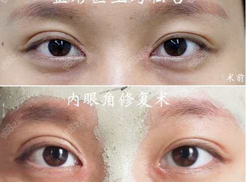 广州最擅长做眼部修复的医生排名