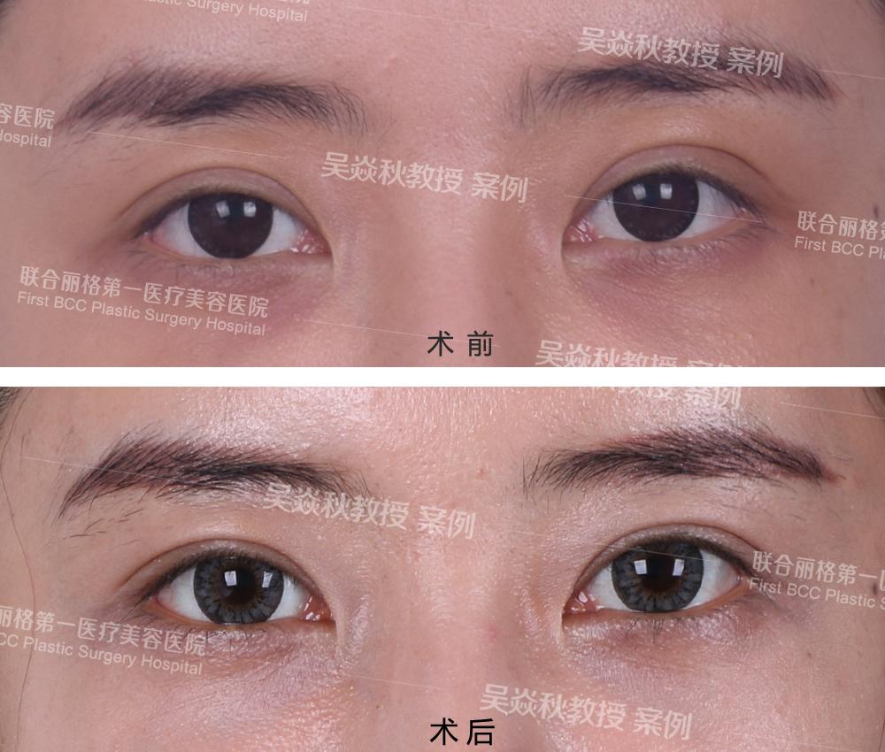 北京最有名的眼修复专家都有哪些